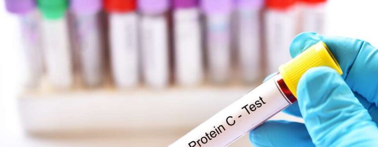 Proteina C Reattiva - quali informazioni fornisce?