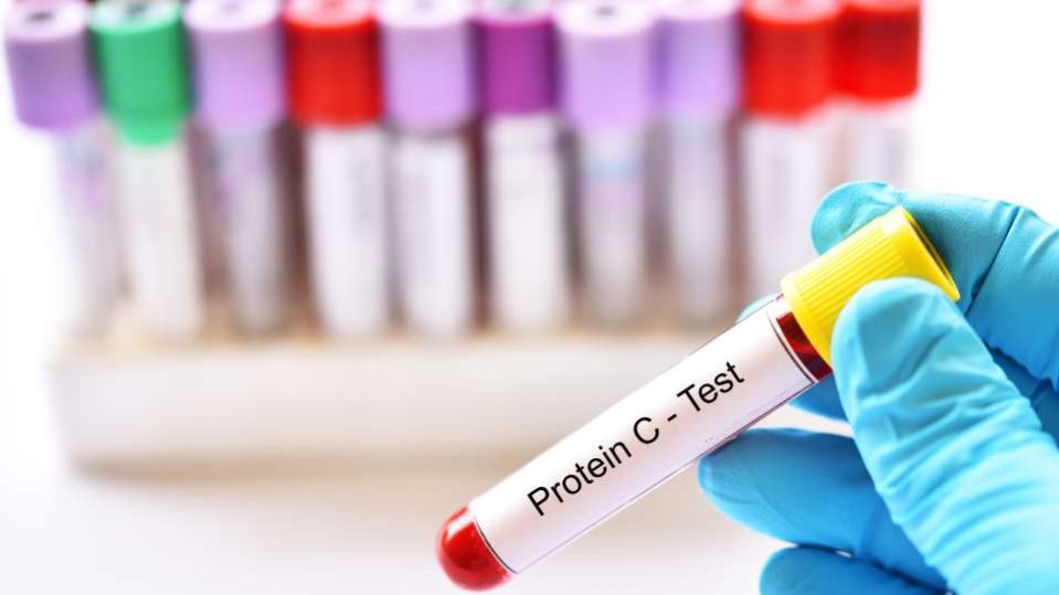 Proteina C Reattiva - quali informazioni fornisce?