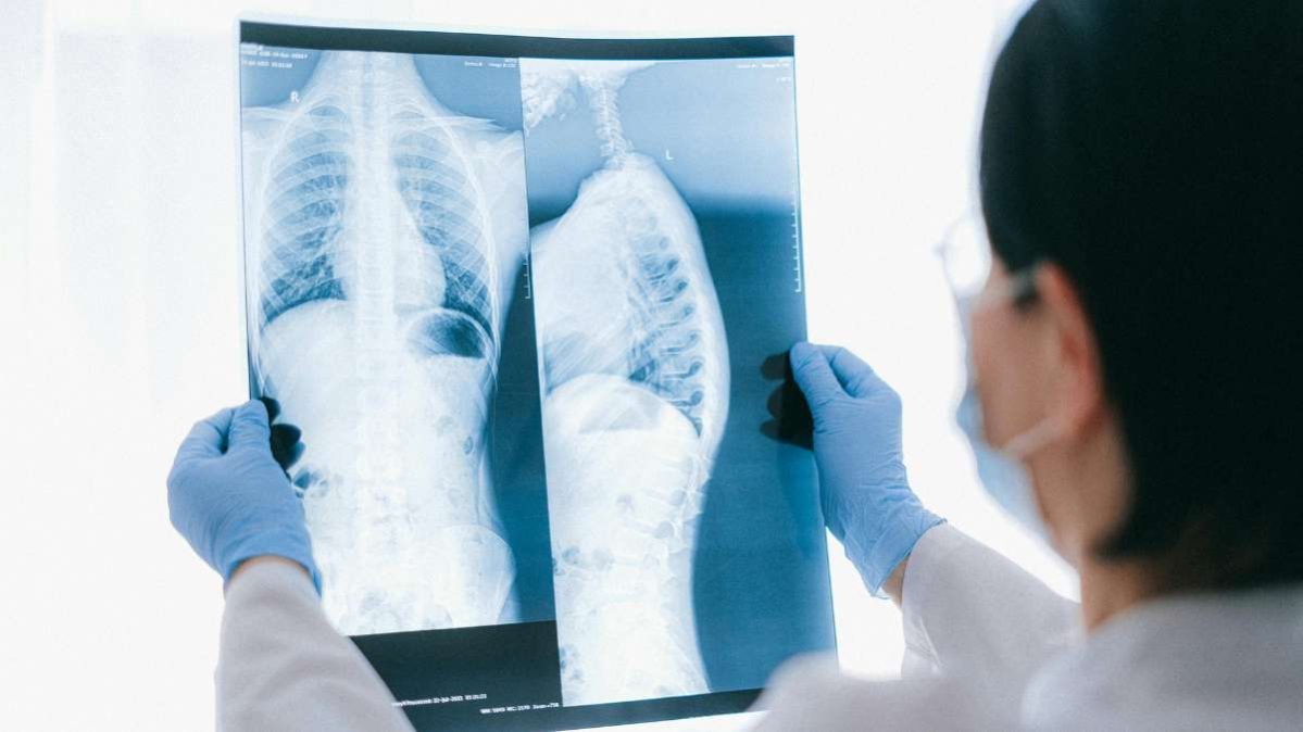 Mediastino - struttura e suddivisione anatomica spiegate in modo semplice